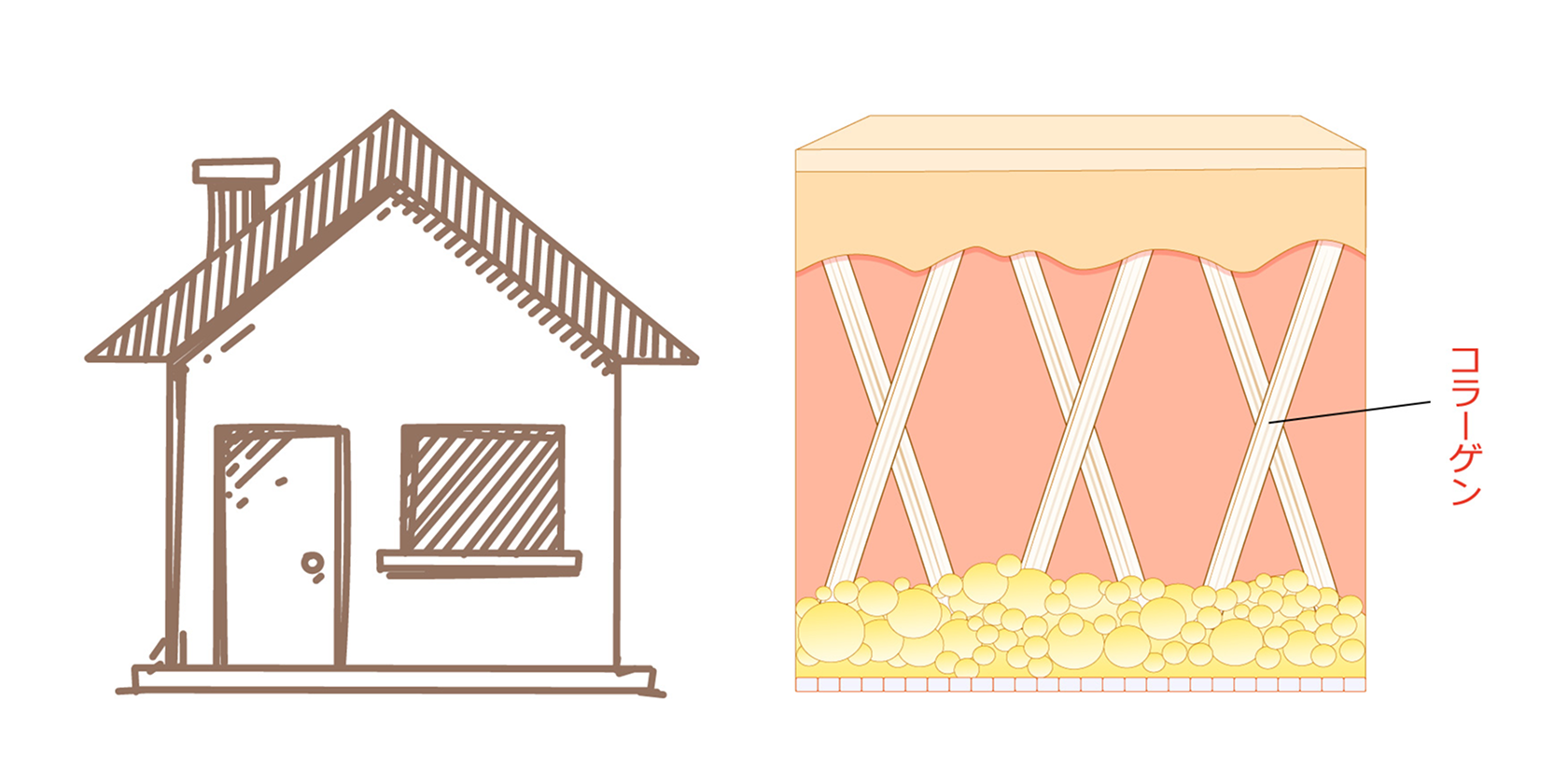 家のイラストと肌の断面図
