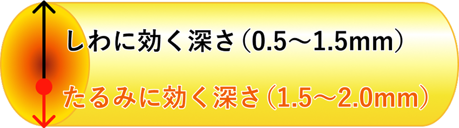 しわに効く深さ、たるみに効く深さ